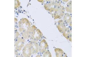 Immunohistochemistry of paraffin-embedded human stomach using ATP2C1 antibody (ABIN5975353) at dilution of 1/100 (40x lens). (ATP2C1 抗体)