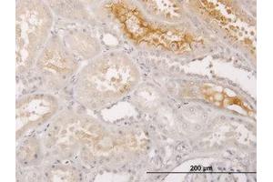 Image no. 1 for anti-S100 Calcium Binding Protein A5 (S100A5) (AA 1-91) antibody (ABIN598911) (S100A5 抗体  (AA 1-91))
