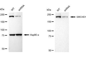 Western blotting analysis using SMCHD1 antibody (ABIN7800450).