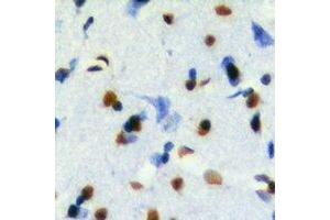 Immunohistochemical analysis of TEL2 staining in mouse brain formalin fixed paraffin embedded tissue section. (ETV7 抗体)