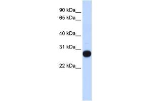 WB Suggested Anti-TCEAL4 Antibody Titration:  0. (TCEAL4 抗体  (Middle Region))