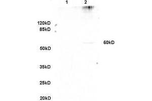 Formalin-fixed and paraffin embedded rat lung labeled with Anti-GPNMB/Osteoactivin Polyclonal Antibody, Unconjugated (ABIN749093) at 1:200 followed by conjugation to the secondary antibody and DAB staining. (Osteoactivin 抗体  (AA 81-180))