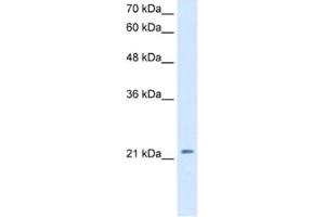 Western Blotting (WB) image for anti-Dickkopf Homolog 1 (DKK1) antibody (ABIN2463124) (DKK1 抗体)