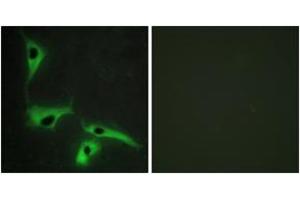 Immunofluorescence analysis of HeLa cells, using TSPAN8 Antibody. (Tspan-8 抗体  (AA 96-145))