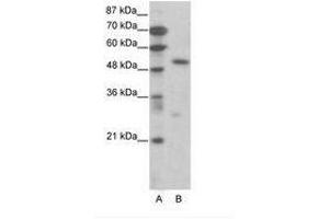 Image no. 1 for anti-Transcription Factor 7 (T-Cell Specific, HMG-Box) (TCF7) (AA 391-440) antibody (ABIN6736068) (TCF7 抗体  (AA 391-440))