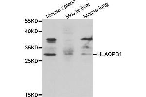 Western blot analysis of extracts of various cell lines, using HLA-DPB1 antibody. (HLA-DPB1 抗体)