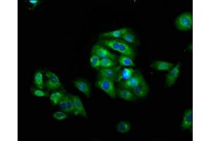 Immunofluorescence staining of HepG2 cells with ABIN7158613 at 1:66, counter-stained with DAPI. (LAG3 抗体  (AA 29-450))