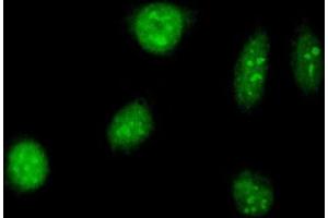 Immunofluorescence of purified MaxPab antibody to TAF12 on HeLa cell.