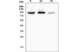 Western blot analysis of RASAL1 using anti-RASAL1 antibody (ABIN6719367).