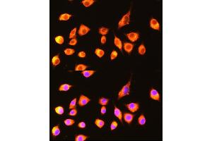 Immunofluorescence analysis of L929 cells using GBP2 Rabbit pAb  at dilution of 1:100 (40x lens). (GBP2 抗体  (AA 410-520))