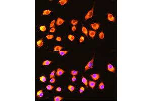 Immunofluorescence analysis of L929 cells using GBP2 Rabbit pAb  at dilution of 1:100 (40x lens). (GBP2 抗体  (AA 410-520))