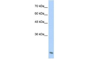 AES antibody used at 2. (AES 抗体  (C-Term))