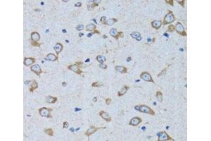 Immunohistochemistry of paraffin-embedded Rat brain using RARS Polyclonal Antibody at dilution of 1:100 (40x lens). (RARS 抗体)