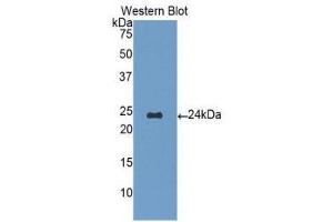 Western Blotting (WB) image for anti-Orosomucoid 1 (ORM1) (AA 19-201) antibody (ABIN1077768) (ORM1 抗体  (AA 19-201))