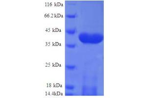 NADH Dehydrogenase (Ubiquinone) Fe-S Protein 5, 15kDa (NADH-Coenzyme Q Reductase) (NDUFS5) (AA 2-106), (full length) protein (GST tag)