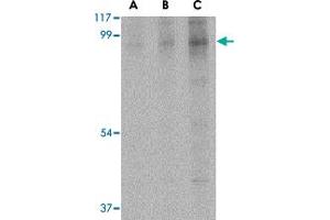 Western blot analysis of BRSK2 in human brain tissue lysate with BRSK2 polyclonal antibody  at (A) 0. (BRSK2 抗体  (C-Term))