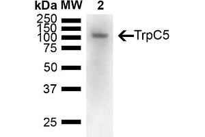 Western Blotting (WB) image for anti-Transient Receptor Potential Cation Channel, Subfamily C, Member 5 (TRPC5) (AA 827-845) antibody (ABIN863137)