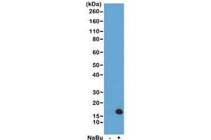 Western blot of acid extracts from HeLa cells untreated (-) or treated (+) with sodium butyrate using recombinant H3K4ac antibody at 0. (Recombinant Histone 3 抗体  (acLys4))