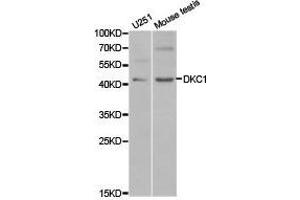 Western Blotting (WB) image for anti-Dyskeratosis Congenita 1, Dyskerin (DKC1) antibody (ABIN1872276) (DKC1 抗体)