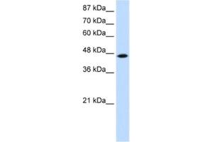 Western Blotting (WB) image for anti-tRNA Isopentenyltransferase 1 (TRIT1) antibody (ABIN2461883)
