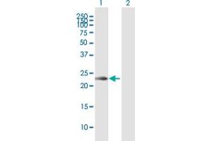 Western Blotting (WB) image for anti-Killer Cell Lectin-Like Receptor Subfamily C, Member 2 (KLRC2) (AA 1-231) antibody (ABIN517358)