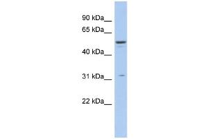 WB Suggested Anti-TRIM14 Antibody Titration:  0. (TRIM14 抗体  (Middle Region))
