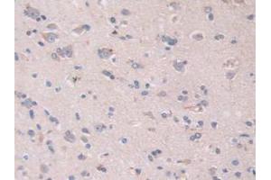 IHC-P analysis of Human Brain Tissue, with DAB staining. (S100A5 抗体  (AA 1-92))