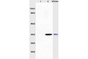 Lane 1: mouse embryo lysates Lane 2: mouse brain lysates probed with Anti AIMP2 Polyclonal Antibody, Unconjugated (ABIN741300) at 1:200 in 4 °C. (AIMP2 抗体  (AA 201-300))