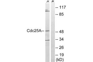 Western blot analysis of extracts from Jurkat cells, using CDC25A (epitope around residue 178) antibody. (CDC25A 抗体  (Ser178))