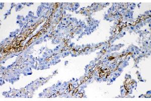 Immunohistochemistry (IHC) image for anti-C-Fos Induced Growth Factor (Vascular Endothelial Growth Factor D) (Figf) (AA 89-205) antibody (ABIN3044524)