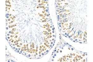ABIN6263429 and ABIN6266804 at 1/100 staining Rat testis tissue by IHC-P. (MUC13 抗体  (C-Term))