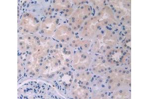 IHC-P analysis of kidney tissue, with DAB staining. (IL12A 抗体  (AA 23-219))