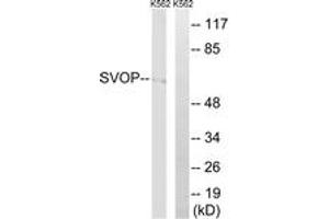 Western blot analysis of extracts from K562 cells, using SVOP Antibody. (SVOP 抗体  (AA 271-320))
