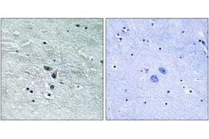 Immunohistochemistry (IHC) image for anti-Mitogen-Activated Protein Kinase Kinase Kinase 8 (MAP3K8) (AA 366-415) antibody (ABIN2889108) (MAP3K8 抗体  (AA 366-415))