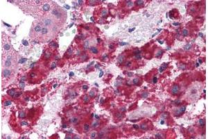 Human Adrenal: Formalin-Fixed, Paraffin-Embedded (FFPE) (LYRM2 抗体  (C-Term))