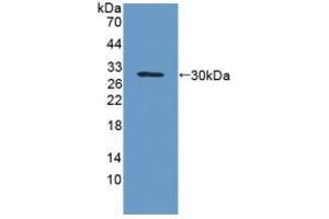 Detection of Recombinant GPA33, Rat using Polyclonal Antibody to Glycoprotein A33 (GPA33) (GPA33 抗体  (AA 22-235))