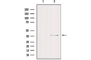 Western blot analysis of extracts from Rat heart, using SGCG Antibody. (SGCG 抗体  (C-Term))