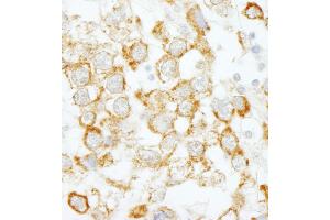 anti-Eukaryotic Translation Initiation Factor 4H (EIF4H) (AA 198-248) antibody