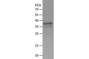 Western Blotting (WB) image for Pleckstrin Homology Domain Containing, Family F (With FYVE Domain) Member 1 (PLEKHF1) (AA 138-279) protein (His-IF2DI Tag) (ABIN7283521) (PLEKHF1 Protein (AA 138-279) (His-IF2DI Tag))
