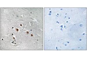 Immunohistochemistry analysis of paraffin-embedded human brain tissue, using MED13L Antibody. (MED13L 抗体  (AA 449-498))
