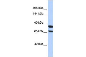 Host:  Rabbit  Target Name:  PGR  Sample Type:  HepG2 Whole cell lysates  Antibody Dilution:  1. (Progesterone Receptor 抗体  (N-Term))