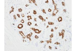 IHC-P Image Immunohistochemical analysis of paraffin-embedded ES2 xenograft, using alpha 2c Adrenergic Receptor, antibody at 1:100 dilution. (ADRA2C 抗体  (C-Term))