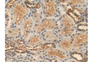 Immunohistochemistry (IHC) image for anti-Heat Shock 70kDa Protein 1A (HSPA1A) (AA 1-641) antibody (ABIN7433138)
