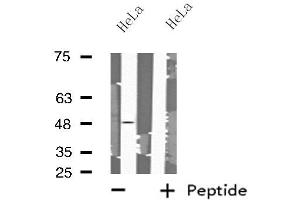 Western blot analysis of extracts from HeLa cells using MRPS27 antibody.