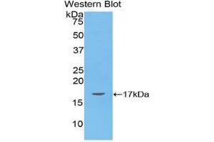 Western blot analysis of the recombinant protein. (ANGPTL4 抗体  (AA 286-409))