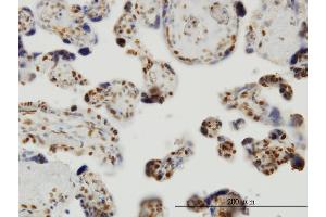 Immunoperoxidase of monoclonal antibody to THUMPD1 on formalin-fixed paraffin-embedded human placenta. (THUMPD1 抗体  (AA 1-353))