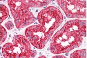Immunohistochemistry (IHC) image for anti-Abhydrolase Domain Containing 5 (ABHD5) (Internal Region) antibody (ABIN190850)