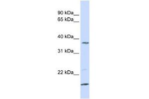 anti-Zinc Finger, DHHC-Type Containing 19 (ZDHHC19) (N-Term) antibody