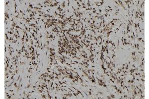 ABIN6261384 and ABIN6274008 at 1/100 staining Human gastric tissue by IHC-P. (DUSP6 抗体  (Internal Region))