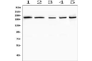 Western blot analysis of SMARCA2 using anti-SMARCA2 antibody (ABIN7600367).